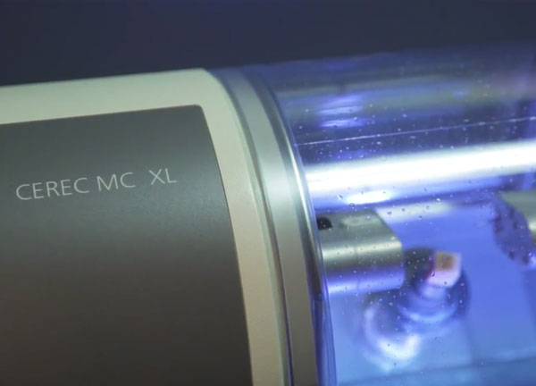 CEREC Same Day Crowns