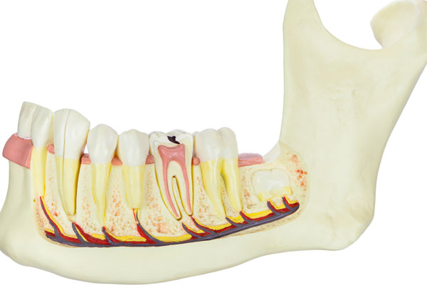 Before Dental Implants