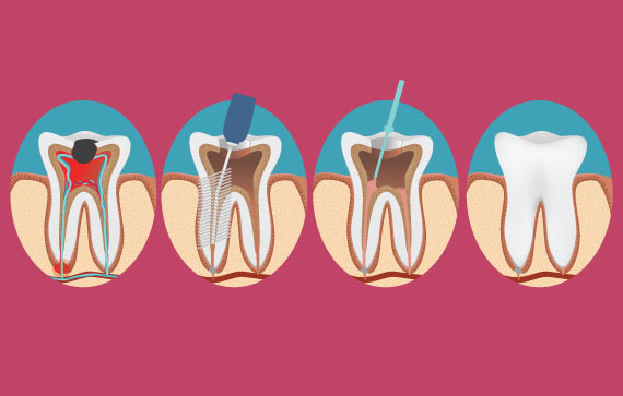 Pediatric Dentistry