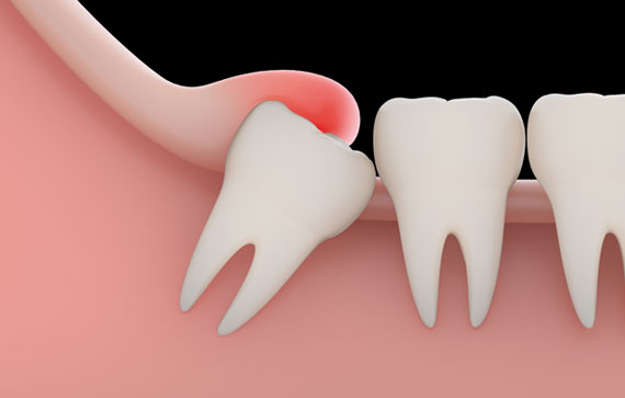 Pediatric Dentistry