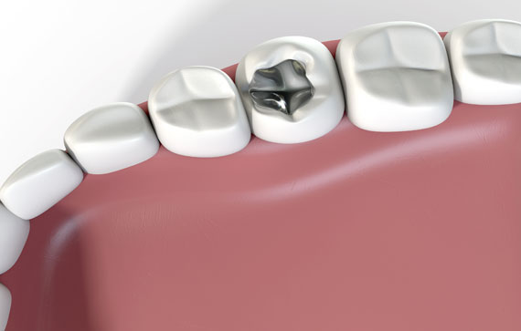 Pediatric Dentistry