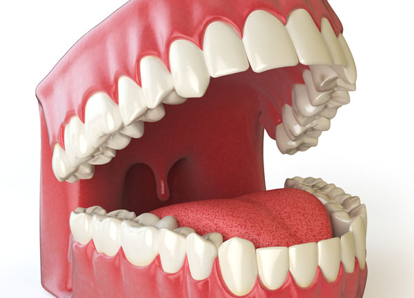 Before Dental Implants 