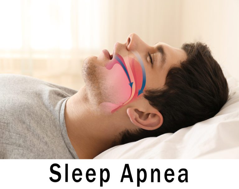 Let Your Dentist Help You Stop Snoring